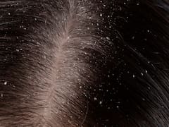 Adiós caspa para siempre: el champú barato de Cruz Verde que suaviza el cabello a menos de $15.900