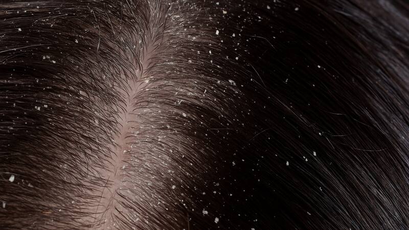 Está disponible en Cruz Verde con descuento y cuesta menos de lo que muchos imaginan.