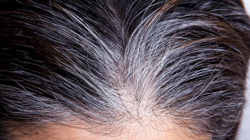 Recientes estudios señalan que la deficiencia de vitamina B12 puede ser clave en su aparición prematura. Foto: Archivo.