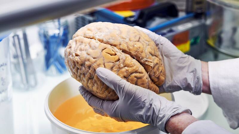 Se descubrió una de las claves de la juventud del cerebro. Fuente: Archivo