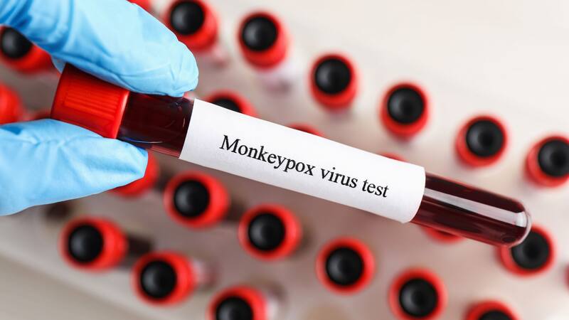 <div class="migrated-promo-image__description"><div class="migrated-promo-image__source">Fuente: Shutterstock</div></div>