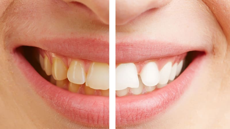 <div class="migrated-promo-image__description"><div class="migrated-promo-image__source">Fuente: Shutterstock</div></div>