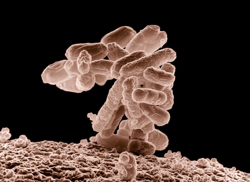 La Escherichia coli puede provocar desde gastroenteritis leve hasta complicaciones graves, especialmente en personas con defensas debilitadas. (Fuente: Wikimedia Commons / Eric Erbe)