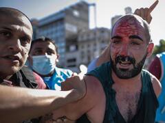 El Gobierno se desliga de los incidentes en el velatorio y carga la culpa sobre Rodríguez Larreta