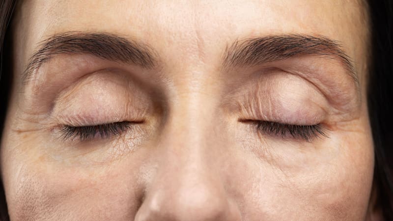 Adiós a las bolsas debajo de los ojos para siempre: el truco para eliminarlas con remedios naturales.