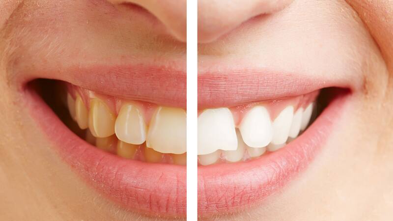 <div class="migrated-promo-image__description"><div class="migrated-promo-image__source">Fuente: Shutterstock</div></div>