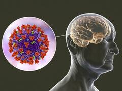 COVID: qué se sabe de la "niebla mental", el síntoma del coronavirus prolongado