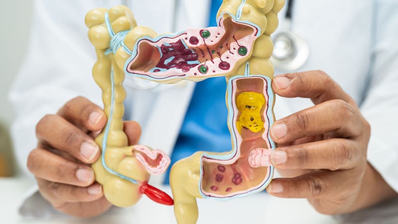 <div class="migrated-promo-image__description"><div class="migrated-promo-image__source">Fuente: Shutterstock</div></div>