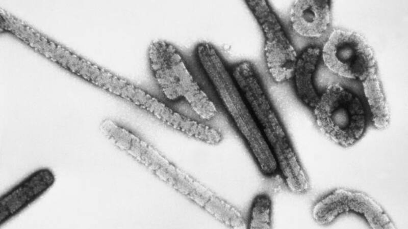 Virus Marburgo. Fuente: Wikipedia