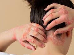 Alerta mortal: retiran del mercado este champú muy usado por riesgo de una bacteria mortal