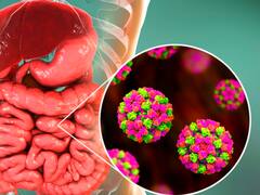 "Diarrea viral": este es el "norovirus" que produce gastroenteritis y se encuentra en el agua de todas estas playas