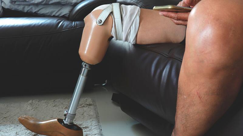 La Seguridad Social ofrece prestaciones ortoprotésicas: cómo acceder al beneficio.