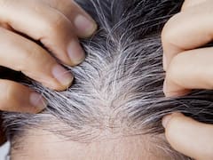 Adiós a las canas para siempre: el motivo por el cual te salen cada vez más y cómo evitarlo
