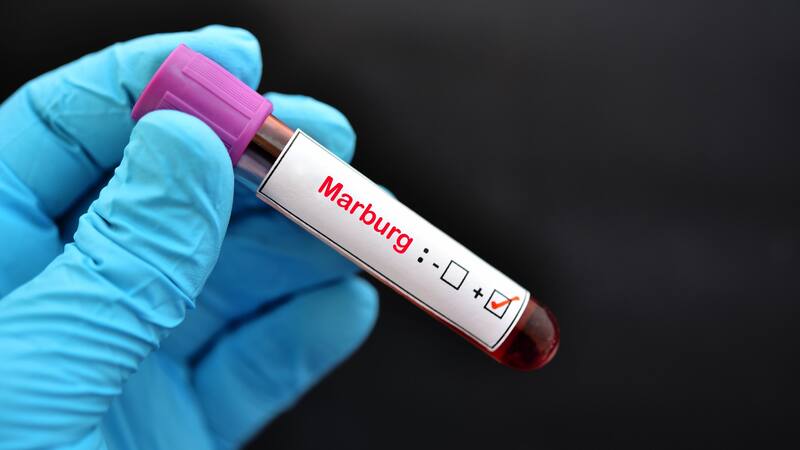 Emergencia internacional | Un nuevo virus, similar al ébola, se expande por el mundo: ya hay 26 casos confirmados.