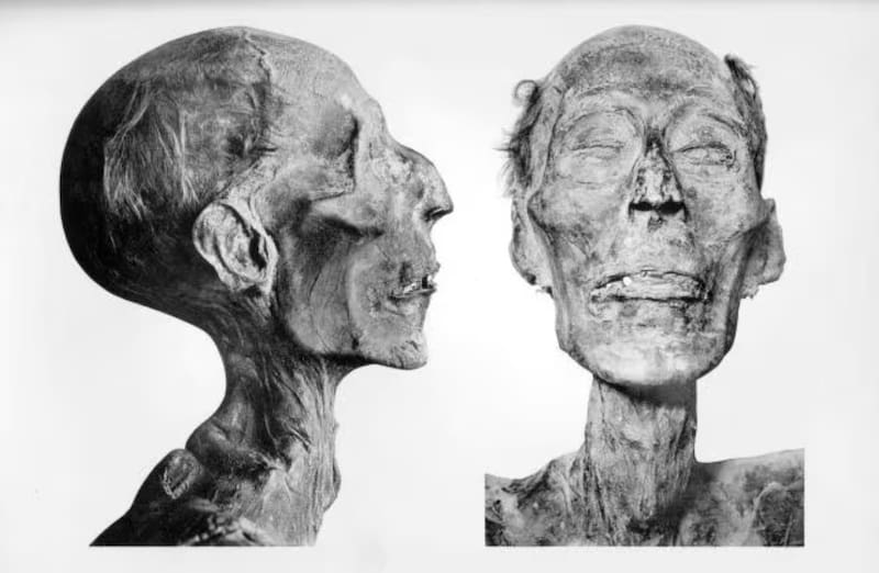 La momia de Ramsés II es una de las mejores conservadas de la historia. (Fuente: G. Elliot Smith / Wikimedia)