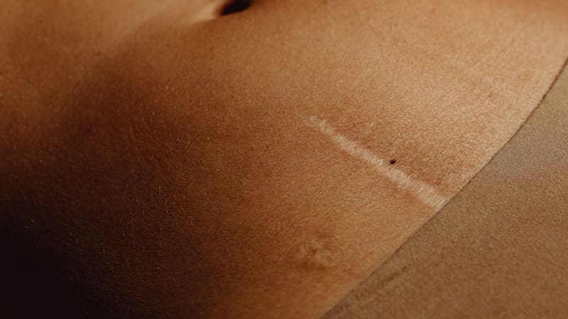 <div class="migrated-promo-image__description"><div class="migrated-promo-image__source">Fuente: Pexels</div></div>