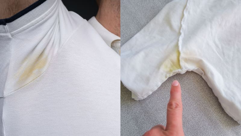 Las manchas amarillas en la ropa provocadas por residuos de sudor y ciertos desodorantes que contienen aluminio, suelen ser un dolor de cabeza dado a lo complicado que puede ser removerlas. Fuente: Shutterstock.