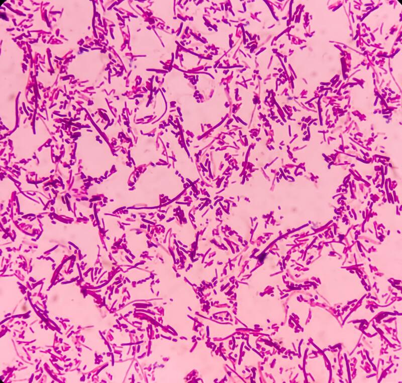 La samoneleosis es una infección bacteriana que puede causar enfermedades gastrointestinales(Fuente: Shutterstock)