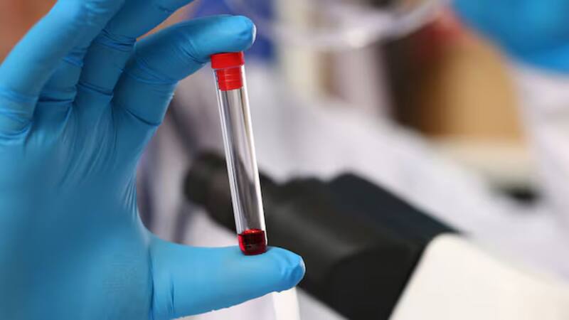 Después de un mes, las células con las mutaciones del gen DNMT3A mostraron un crecimiento un 50% más rápido que las células sin las mutaciones. Fuente: Shutterstock.