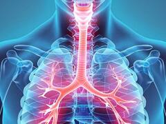 "La peor epidemia que tengamos registro": cuál es la enfermedad que preocupa luego del COVID