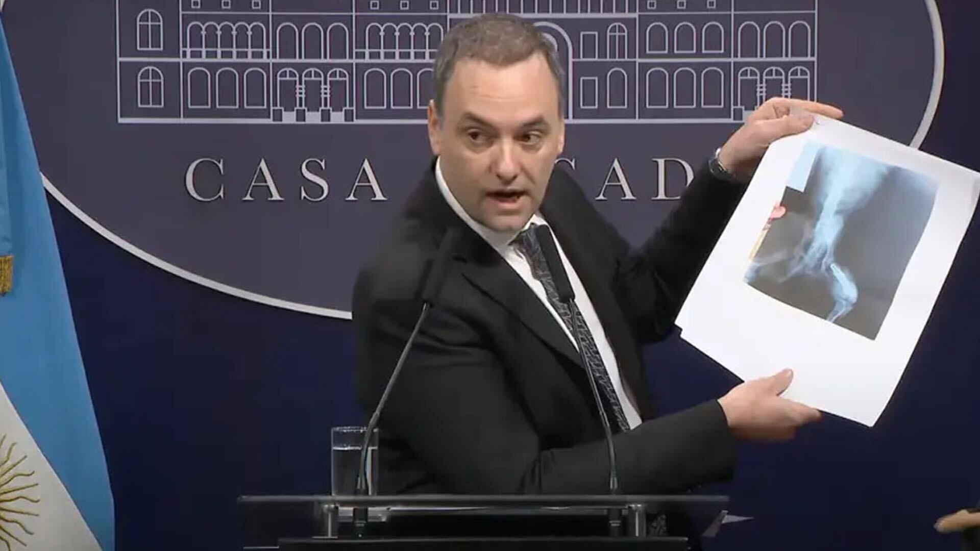 Cambia el Certificado Único de Discapacidad: cuándo hay que renovarlo en 2026 y qué requisitos se debe cumplir