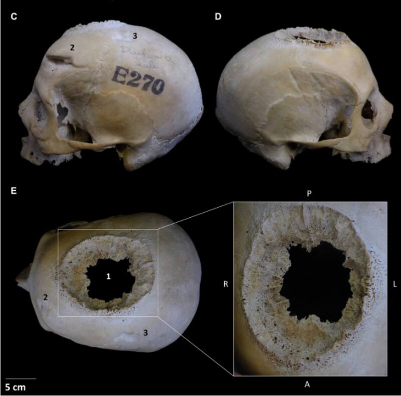 El increíble hallazgo científico que muestra el método de los egipcios para curar el cáncer hace 4000 años.