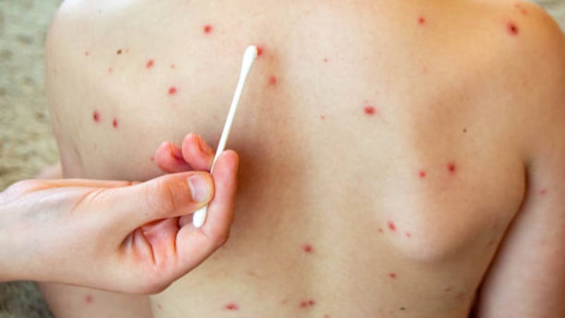 <div class="migrated-promo-image__description"><div class="migrated-promo-image__source">Fuente: iStock</div></div>