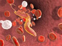 La enfermedad silenciosa que puede arruinar el corazón, ¿cómo se detecta y cuáles son sus características?