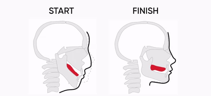 El mewing, una técnica que permite mejorar la apariencia facial. Fuente: Mewing Coach.