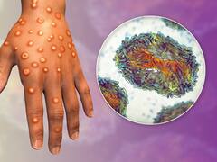 Alerta sanitaria: detectaron una nueva variante mortal de un virus en Estados Unidos