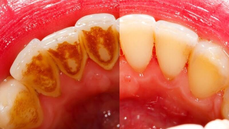 <div class="migrated-promo-image__description"><div class="migrated-promo-image__source">Fuente: Archivo </div></div>