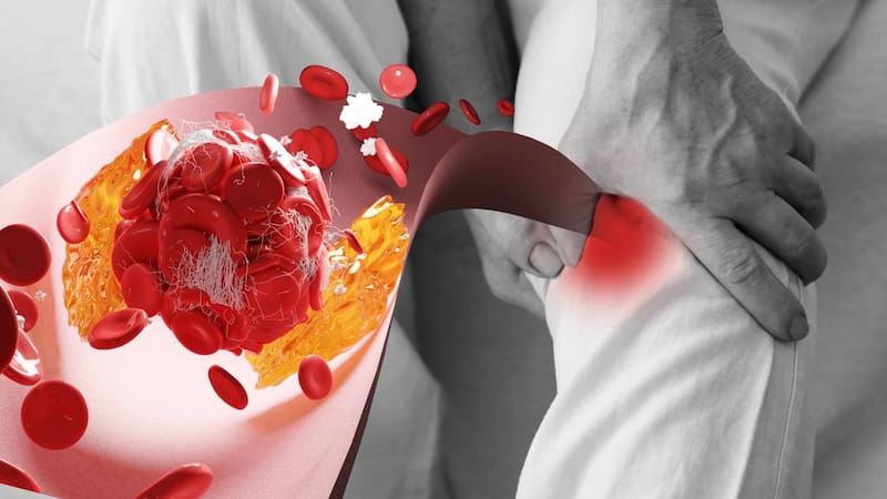 Cuidar los niveles de colesterol es clave para promover una vida saludable y prevenir enfermedades cardiovasculares.