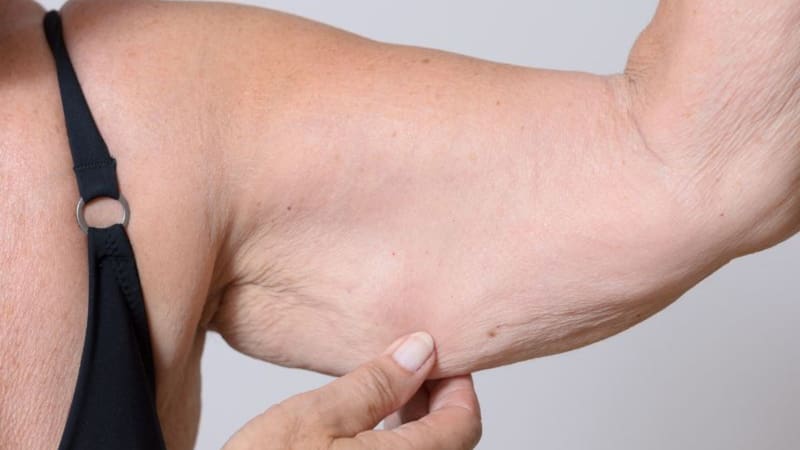 <div class="migrated-promo-image__description"><div class="migrated-promo-image__source">Fuente: brazo</div></div>