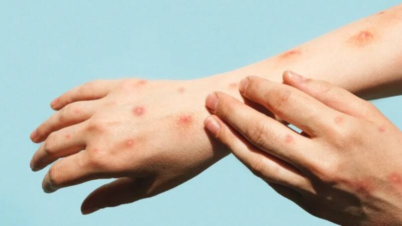 <div class="migrated-promo-image__description"><div class="migrated-promo-image__source">Fuente: Archivo</div></div>