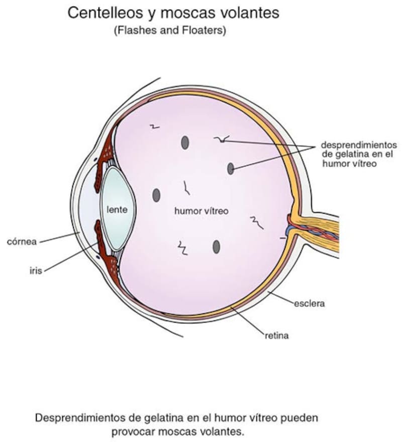 Fuente: Sociedad Oftalmológica de la Comunidad Velnciana.