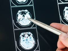 El cáncer silencioso que se disfraza de dolor de espalda: detectarlo a tiempo puede salvarle la vida