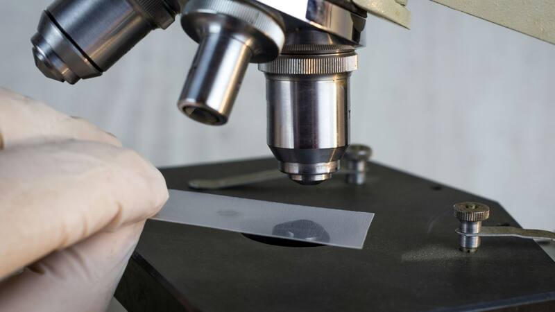 La modificación del microbioma intestinal podría ofrecer una estrategia preventiva contra el colesterol alt.