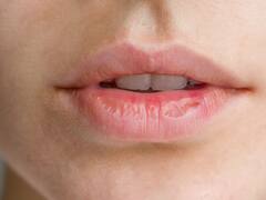 Chau labios secos o lastimados: el método casero con aceite de oliva para curarlos en poco tiempo