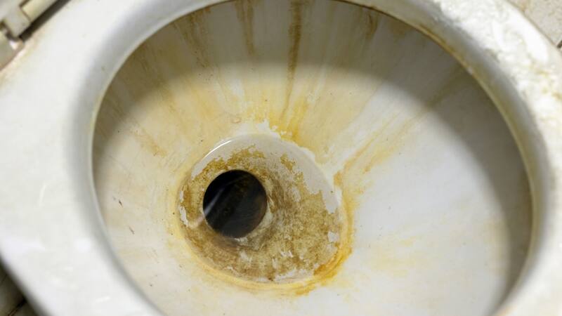 El sarro se debe a la acumulación de minerales.