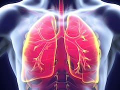 Brote de Legionella confirmado en Tucumán: hay un nuevo muerto y ya suman cinco