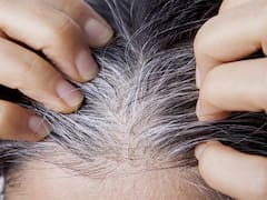 El truco secreto del vinagre de manzana para eliminar las canas en tiempo récord: lucirás hasta 10 años más joven