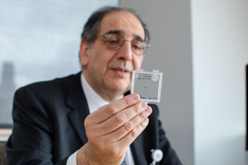 Jose-Alain Sahel, investigador de oftalmología de la Universidad estadounidense de Pittsburgh, sostiene el implante ocular. (Fuente: EFE/ Consorcio Science Corporation)