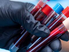 El peor tipo de sangre: un estudio científico reveló el grupo que tiene más posibilidades de sufrir infartos