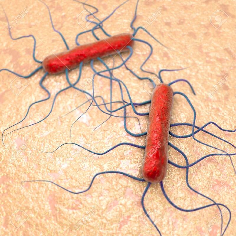 La contaminación por listeria suele presentarse con frecuencia en los alimentos. Fuente: Archivo.