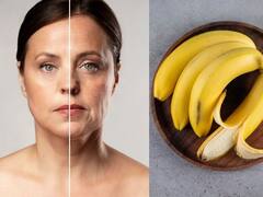 La cáscara de banana que tiene efectos milagrosos para la piel, combate el acné y es un rico antioxidante
