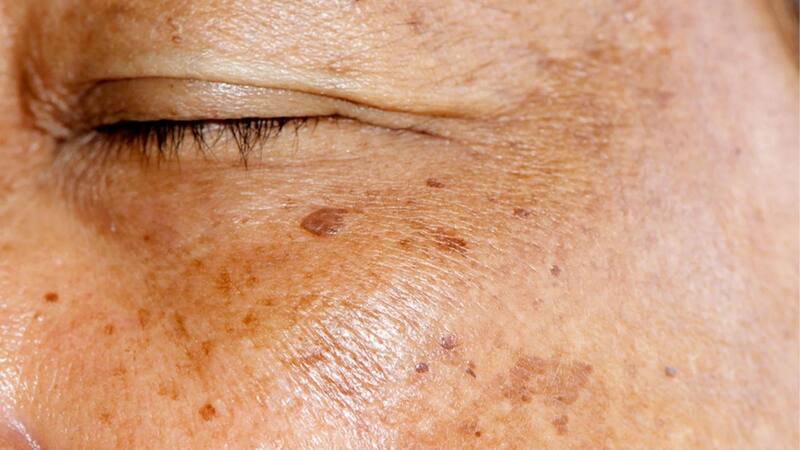 <div class="migrated-promo-image__description"><div class="migrated-promo-image__source">Fuente: vecteezy</div></div>