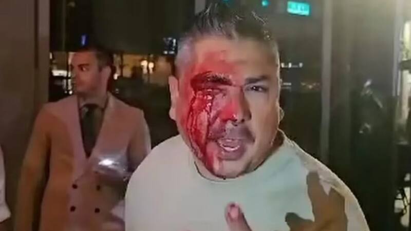 <div class="migrated-promo-image__description"><div class="migrated-promo-image__source">Fuente: Captura video: TN</div></div>