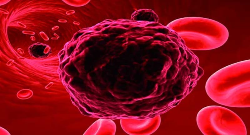 Los principales factores de riesgo para el estudio son la coagulación y el nivel de colesterol malo.