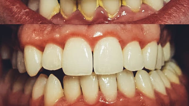 Se trata de una fórmula hecha con ingredientes fáciles de conseguir y de aplicar en casa.