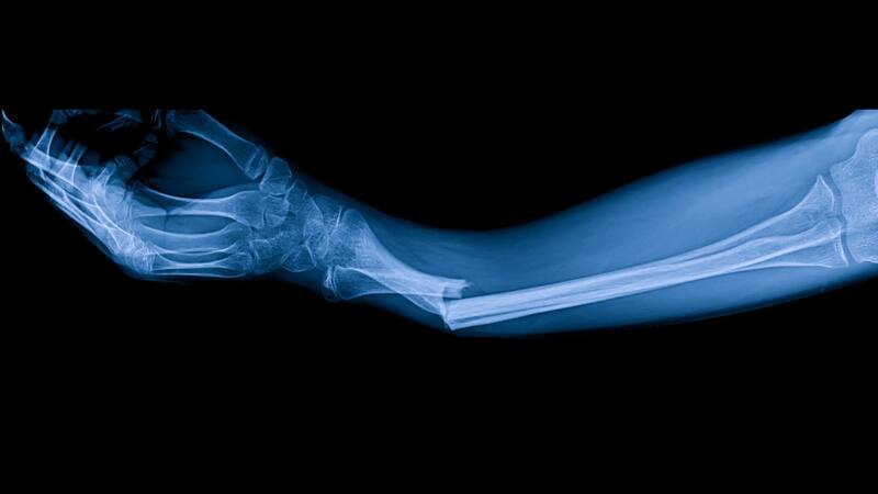 <div class="migrated-promo-image__description"><div class="migrated-promo-image__source">Fuente: Shutterstock</div></div>